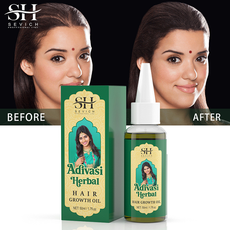 زيت عشبي للشعر للرجال ، زيت عش - مراجعة Ayurvedic & Herbal Wellness Kits وسعره